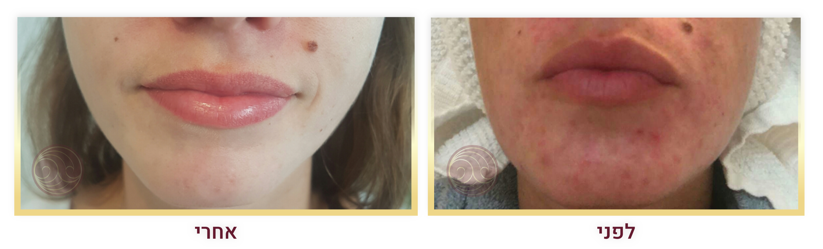 גלריית לפני אחרי 1-01