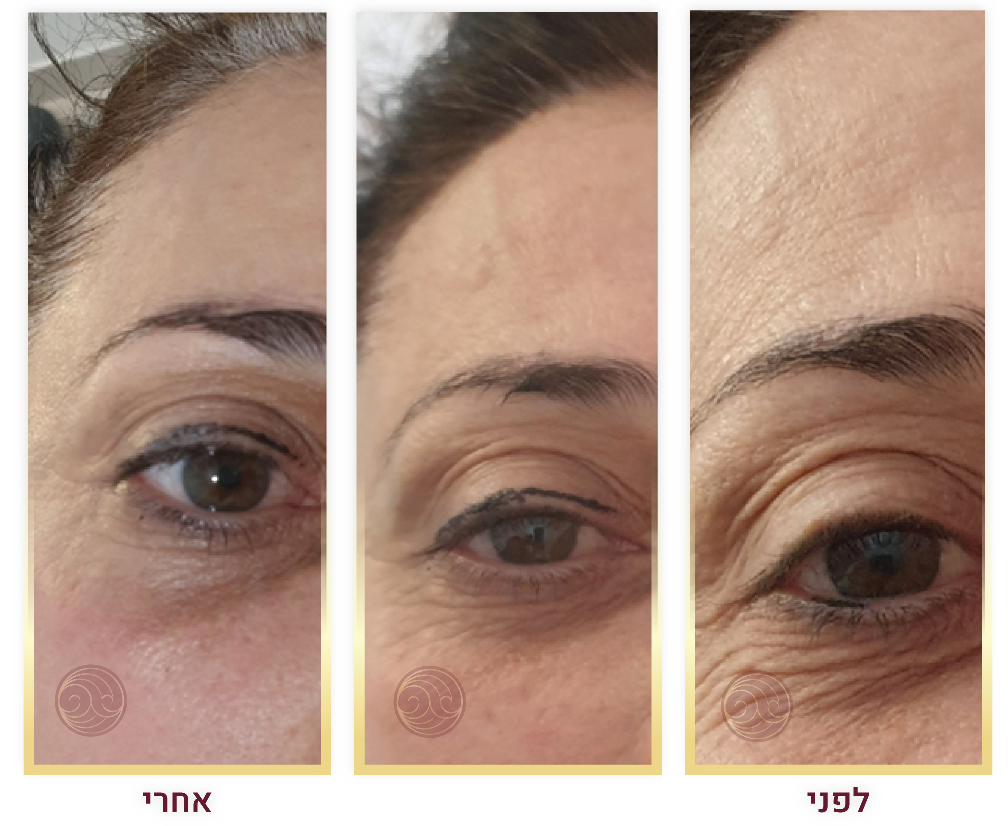 גלריית לפני אחרי 2-01