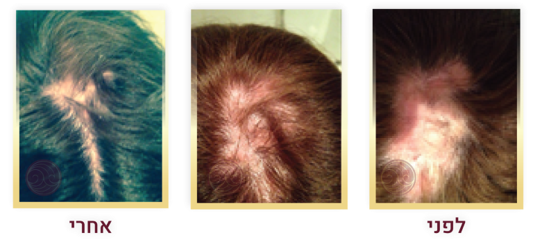 21-01 3 frames 768X359